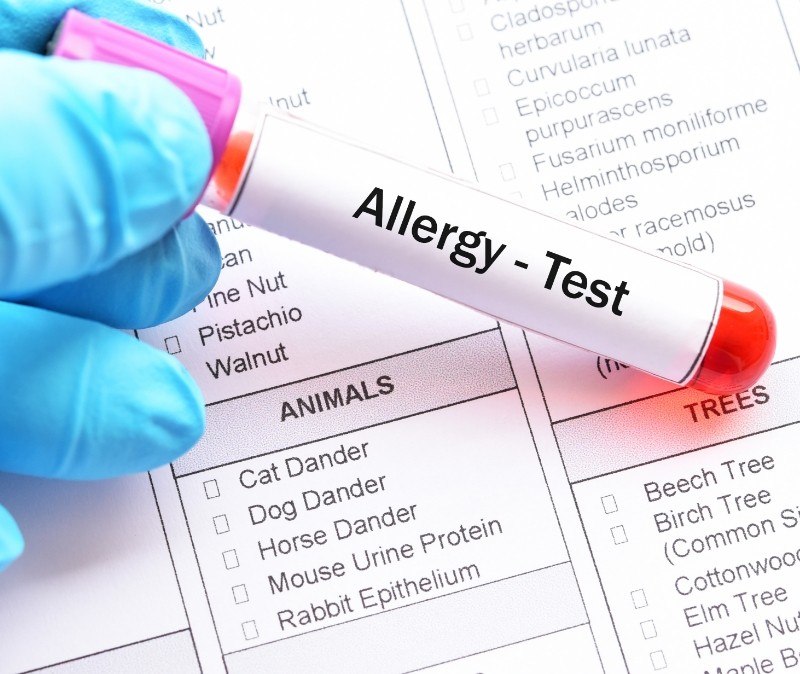 Allergy test kit