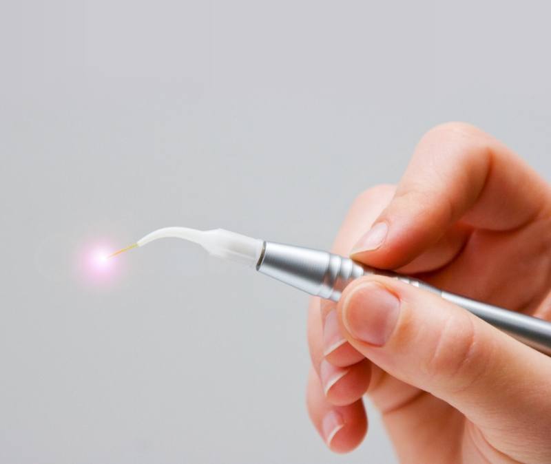 Hand holding soft tissue laser dentistry hand tool