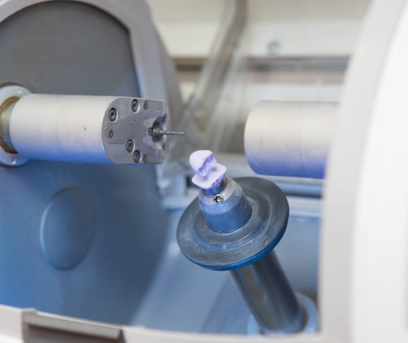 Closeup of CEREC system crafting dental crown