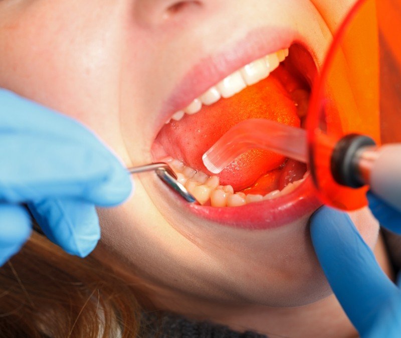 Closeup of dentistry patient receiving dental bonding