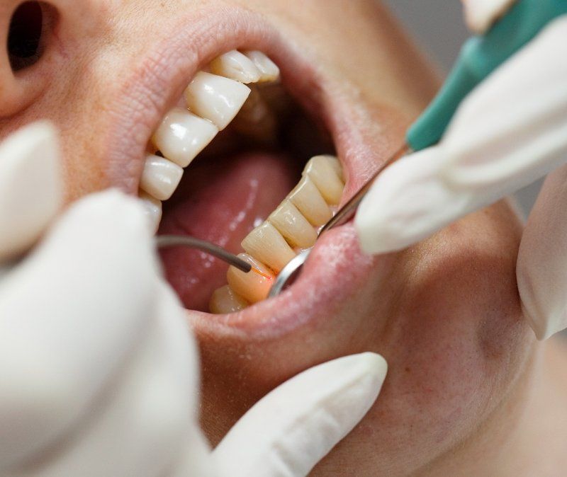 Dental patient receiving laser gum disease treatment