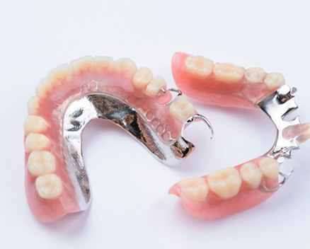 Two partial dentures with metal attachments