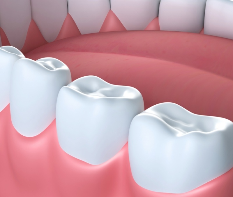 Animated smile after amalgam filling removal