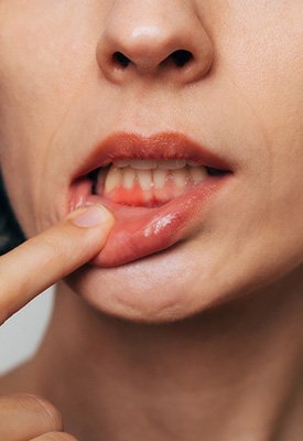 Woman with gum inflammation