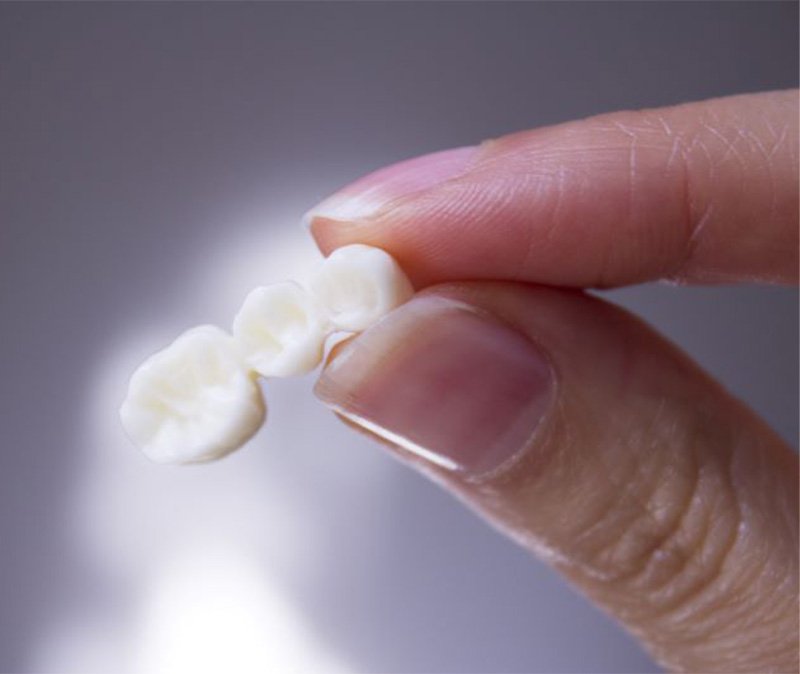 Person holding a dental bridge between thumb and forefinger