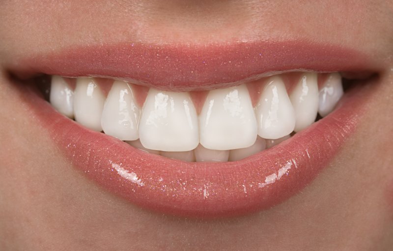 Person’s smile after treatment from a cosmetic dentist in Beachwood.