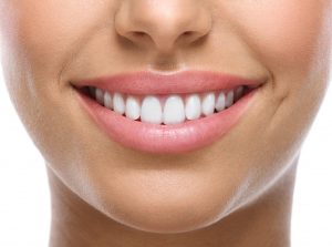 Close-up of woman’s beautiful smile after cosmetic dental treatments