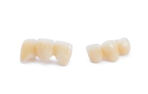 Two dental bridges pictured against white background 